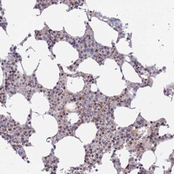 BOD1L Antibody, Novus Biologicals 25 &mu;L, Unlabeled:Antibodies, Polyclonal