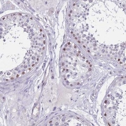 BOP1 Antibody, Novus Biologicals:Antibodies:Primary Antibodies