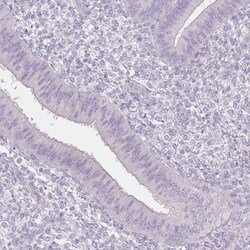 BORIS Antibody, Novus Biologicals 25 &mu;L | Buy Online | Novus Biologicals | Fisher Scientific