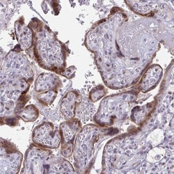 BP1 Antibody, Novus Biologicals:Antibodies:Primary Antibodies
