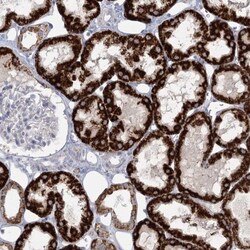 BPHL Antibody, Novus Biologicals:Antibodies:Primary Antibodies