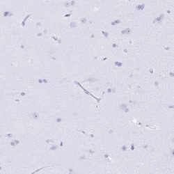 BPI Antibody, Novus Biologicals 0.1mL; Unlabeled:Antibodies, Polyclonal