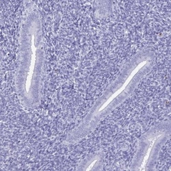 BPIFA3 Antibody, Novus Biologicals:Antibodies:Primary Antibodies