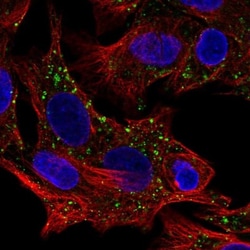 BPIL1 Antibody, Novus Biologicals 25 &mu;L, Unlabeled:Antibodies, Polyclonal
