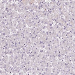 BPIL1 Antibody, Novus Biologicals 25 &mu;L, Unlabeled:Antibodies, Polyclonal