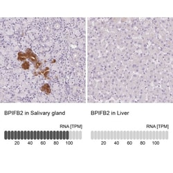 BPIL1 Antibody, Novus Biologicals 25 &mu;L, Unlabeled:Antibodies, Polyclonal