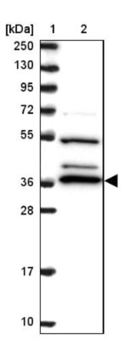 BPNT1 Antibody, Novus Biologicals 0.1 mL | Buy Online | Novus Biologicals | Fisher Scientific