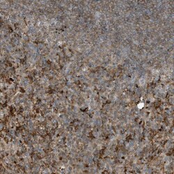 BPOZ Antibody, Novus Biologicals:Antibodies:Primary Antibodies