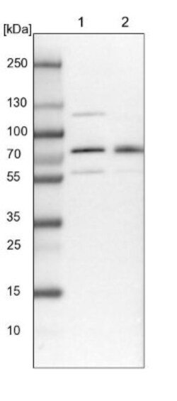 BRAP Antibody, Novus Biologicals 0.1mL; Unlabeled:Antibodies, Polyclonal