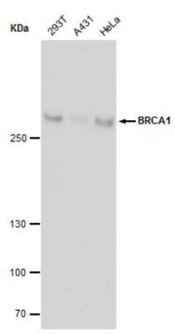 BRCA1 Antibody (17F8), Novus Biologicals 0.1mg; Unlabeled:Antibodies, Monoclonal