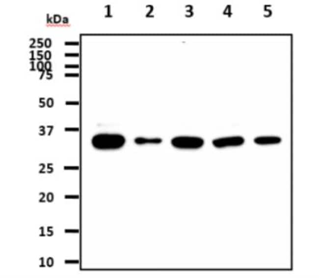 BRCC3 (3B1) - 0.1 ML