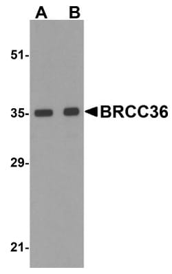 BRCC3 Antibody - BSA Free, Novus Biologicals 0.1mg; Unlabeled:Antibodies,