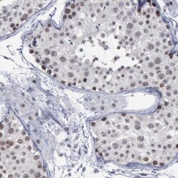 BRD1 Antibody, Novus Biologicals 25 &mu;L; Unlabeled:Antibodies, Polyclonal