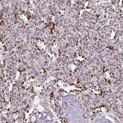 BRD3 Antibody, Novus Biologicals 0.1mL; Unlabeled:Antibodies, Polyclonal