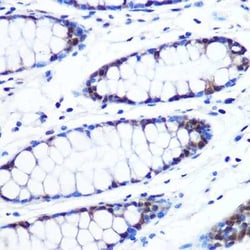 BRD4 Rabbit anti-Human, Clone: 7L7M8, Novus Biologicals 100 &mu;g; Unconjugated:Antibodies,