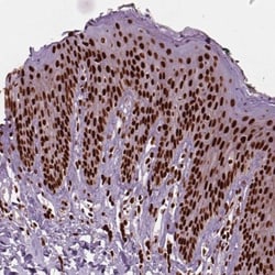 BRD4 Antibody, Novus Biologicals 0.1mL; Unlabeled:Antibodies, Polyclonal