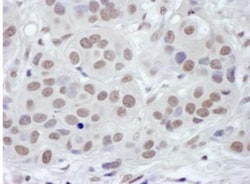 BRD4 Antibody, Novus Biologicals 0.1mL; Unlabeled:Antibodies, Polyclonal