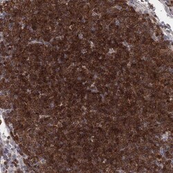 BRDG1/STAP-1 Antibody, Novus Biologicals 25 &mu;L; Unlabeled:Antibodies,