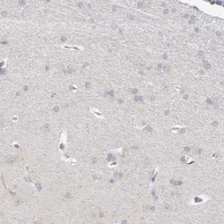 BRDG1/STAP-1 Antibody, Novus Biologicals 25 &mu;L; Unlabeled:Antibodies,