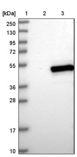 BRE Antibody, Novus Biologicals 0.1mL; Unlabeled:Antibodies, Polyclonal