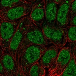 BRI3BP Antibody, Novus Biologicals:Antibodies:Primary Antibodies