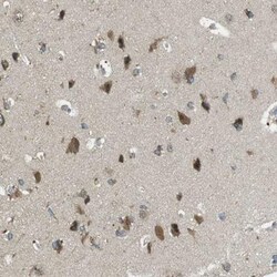 BRI3BP Antibody, Novus Biologicals:Antibodies:Primary Antibodies