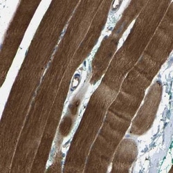 BRIC Antibody, Novus Biologicals 25 &mu;L | Buy Online | Novus Biologicals | Fisher Scientific