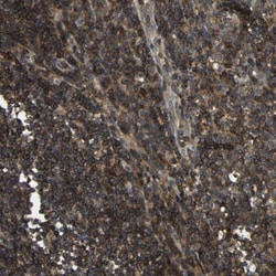 BRIC Antibody, Novus Biologicals 25 &mu;L; Unlabeled:Antibodies, Polyclonal