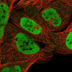BRM Antibody, Novus Biologicals 0.1mL; Unlabeled:Antibodies, Polyclonal