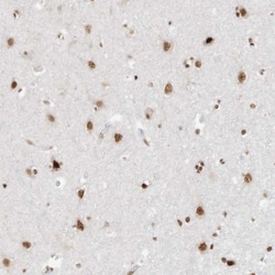 BRM Antibody, Novus Biologicals 0.1mL; Unlabeled:Antibodies, Polyclonal