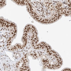 BRM Antibody, Novus Biologicals 0.1mL; Unlabeled:Antibodies, Polyclonal