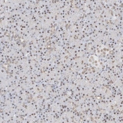 BRM Antibody, Novus Biologicals 0.1mL; Unlabeled:Antibodies, Polyclonal