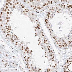 BRM Antibody, Novus Biologicals 0.1mL; Unlabeled:Antibodies, Polyclonal