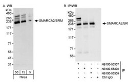 BRM Antibody, Novus Biologicals 0.1 mL | Buy Online | Novus Biologicals | Fisher Scientific