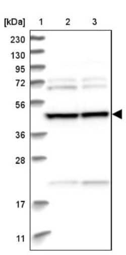 BROX Antibody, Novus Biologicals 25 &mu;L, Unconjugated:Antibodies, Polyclonal