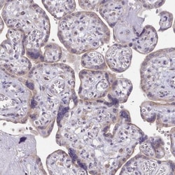 BRP44 Antibody, Novus Biologicals 0.1mL; Unlabeled:Antibodies, Polyclonal
