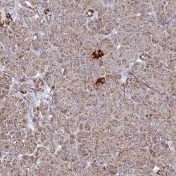 BRP44L Antibody, Novus Biologicals 25 &mu;L | Buy Online | Novus Biologicals | Fisher Scientific
