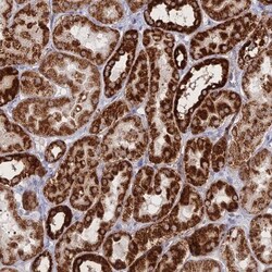 BRP44L Antibody, Novus Biologicals 25 &mu;L | Buy Online | Novus Biologicals | Fisher Scientific