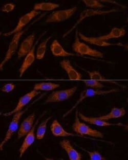 BRPF1 Rabbit anti-Human, Mouse, Rat, Polyclonal, Novus Biologicals:Antibodies:Primary