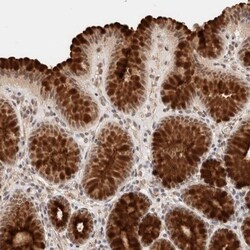 BRPF3 Antibody, Novus Biologicals 25 &mu;L; Unlabeled:Antibodies, Polyclonal