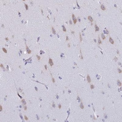BRUNOL5 Antibody, Novus Biologicals 0.1mL; Unlabeled:Antibodies, Polyclonal