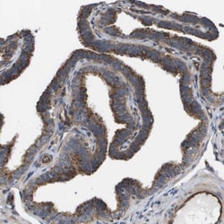 BST2 Antibody, Novus Biologicals:Antibodies:Primary Antibodies