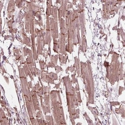 BTBD1 Antibody, Novus Biologicals 25 &mu;L, Unlabeled:Antibodies, Polyclonal