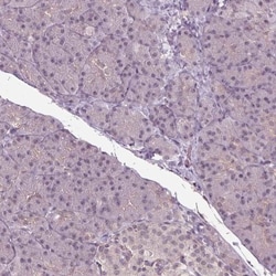 BTBD1 Antibody, Novus Biologicals 25 &mu;L, Unlabeled:Antibodies, Polyclonal