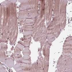 BTBD1 Antibody, Novus Biologicals 25 &mu;L, Unlabeled:Antibodies, Polyclonal
