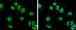 BTBD10 Antibody, Novus Biologicals 0.1mL; Unlabeled:Antibodies, Polyclonal