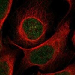 BTBD11 Rabbit anti-Human, Polyclonal, Novus Biologicals:Antibodies:Primary