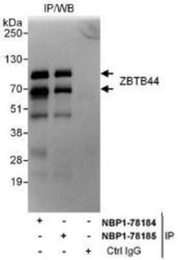 BTBD15 Antibody, Novus Biologicals 0.1mg; Unlabeled:Antibodies, Polyclonal