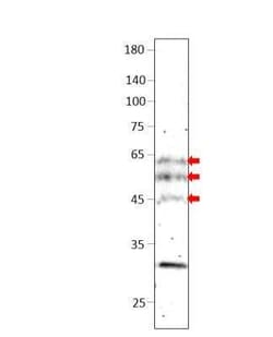 BTBD3 Antibody, Novus Biologicals 100 &mu;g; Unconjugated:Antibodies, Polyclonal