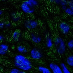 BTBD7 Antibody, Novus Biologicals:Antibodies:Primary Antibodies